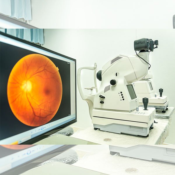 oct macular test